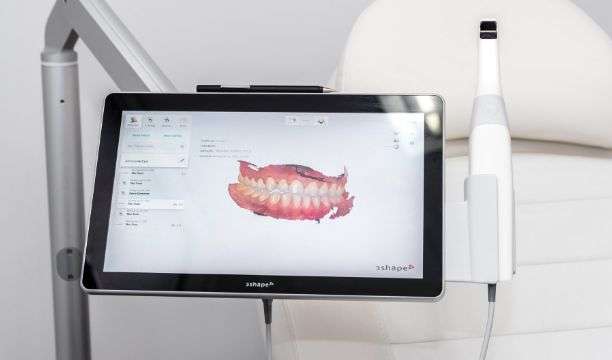 Fotografia de um scanner 3D e da sua simulação 3D de um maxilar após um exame DR SMILE